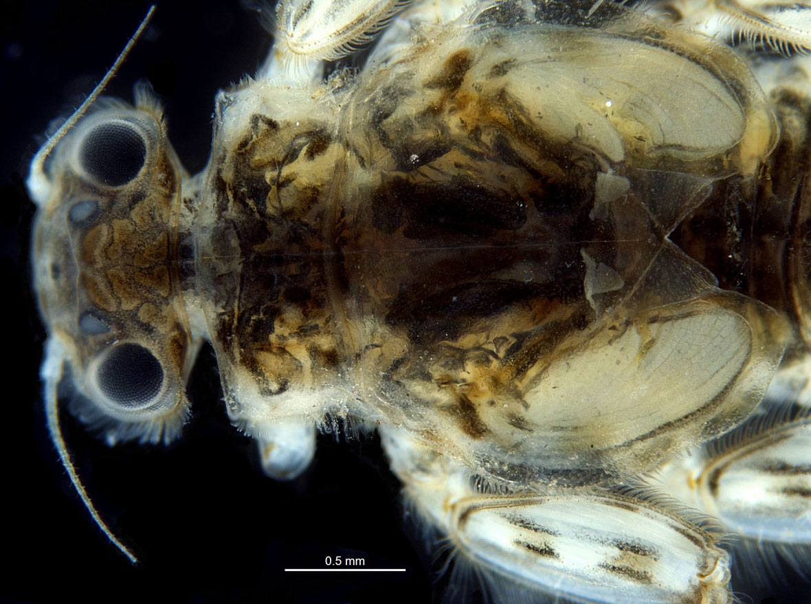 Anterior part